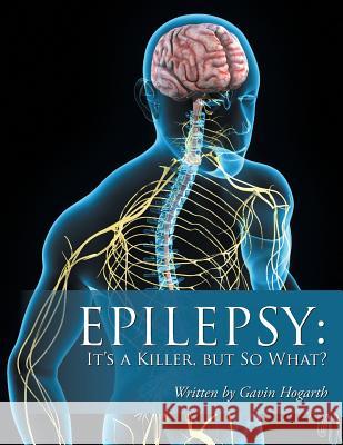 Epilepsy: It'S a Killer, but so What?: Volume Two Gavin Hogarth 9781546287247 Authorhouse UK - książka