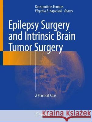 Epilepsy Surgery and Intrinsic Brain Tumor Surgery: A Practical Atlas Fountas, Konstantinos 9783319959177 Springer - książka