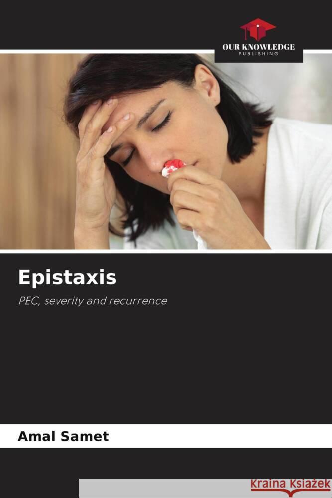 Epistaxis Samet, Amal 9786208623821 Our Knowledge Publishing - książka
