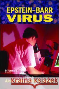 Epstein-Barr Virus Alex Tselis Hal B. Jenson 9780824754259 Taylor & Francis Group - książka