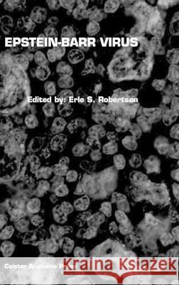 Epstein-Barr Virus Erle S. Robertson 9781904455035 Caister Academic Press - książka