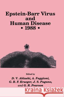 Epstein-Barr Virus and Human Disease - 1988 Ablashi, D. V. 9781461288527 Humana Press - książka