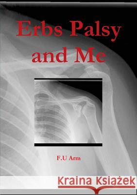 Erbs Palsy and Me F.U Arm 9780244779566 Lulu.com - książka