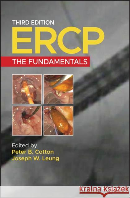 Ercp: The Fundamentals Peter B. Cotton Joseph W. Leung  9781119601098 Wiley-Blackwell - książka
