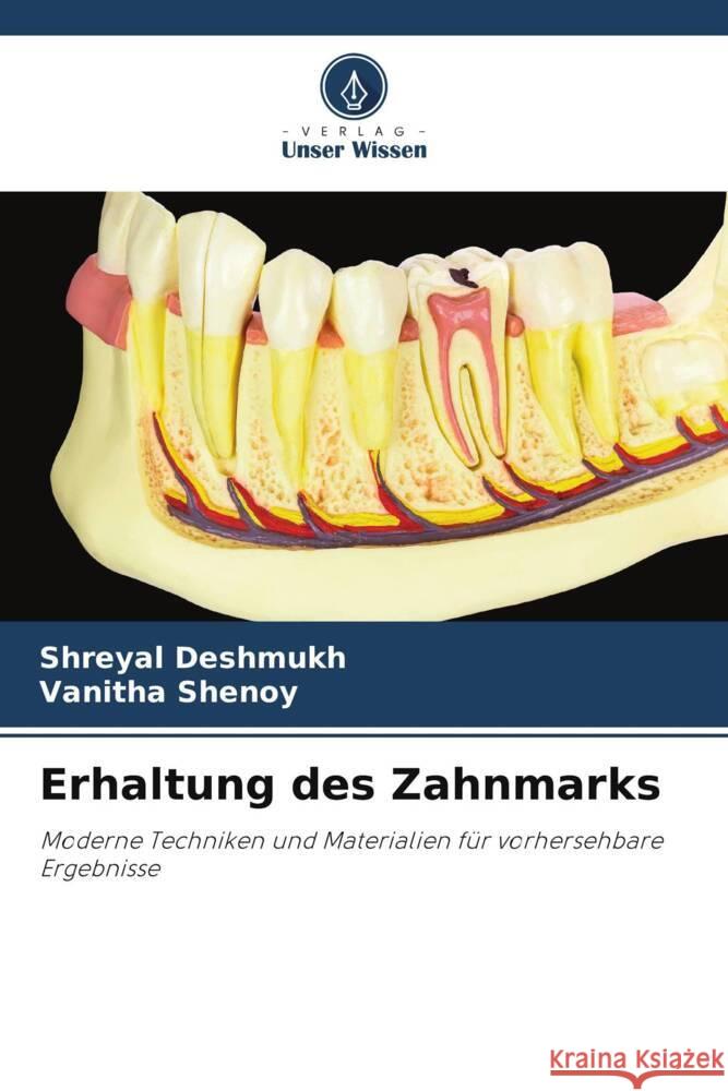 Erhaltung des Zahnmarks Deshmukh, Shreyal, Shenoy, Vanitha 9786206762980 Verlag Unser Wissen - książka