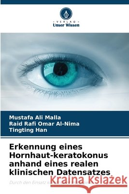 Erkennung eines Hornhaut-keratokonus anhand eines realen klinischen Datensatzes Malla, Mustafa Ali, Al-Nima, Raid Rafi Omar, Han, Tingting 9786630105643 Verlag Unser Wissen - książka