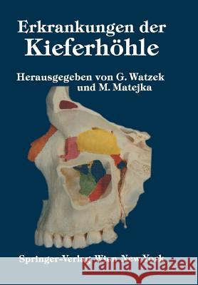 Erkrankungen Der Kieferhöhle: Symposium, Fuschl, 26.-29. September 1985 Watzek, G. 9783709188347 Springer - książka