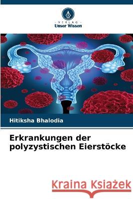 Erkrankungen der polyzystischen Eierstoecke Hitiksha Bhalodia   9786206077671 Verlag Unser Wissen - książka
