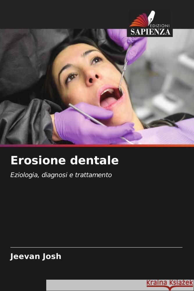 Erosione dentale Jeevan Josh 9786207009619 Edizioni Sapienza - książka