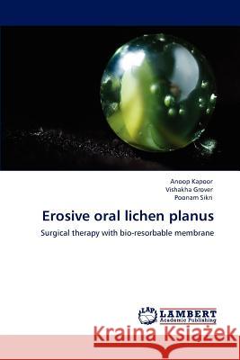 Erosive oral lichen planus Kapoor, Anoop 9783848402366 LAP Lambert Academic Publishing - książka