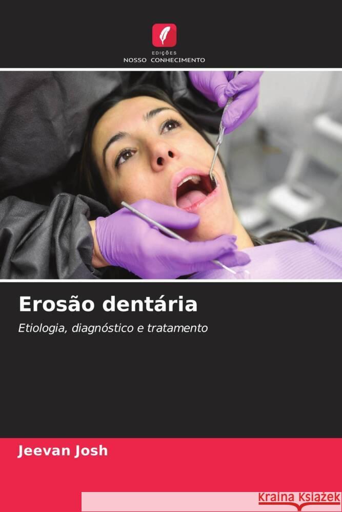 Eros?o dent?ria Jeevan Josh 9786207009596 Edicoes Nosso Conhecimento - książka