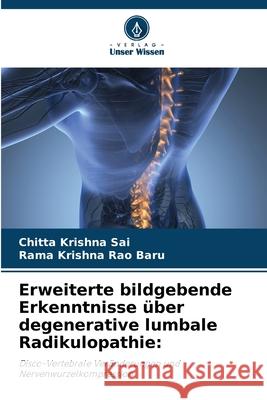 Erweiterte bildgebende Erkenntnisse über degenerative lumbale Radikulopathie: Sai, Chitta Krishna, Baru, Rama Krishna Rao 9786208657345 Verlag Unser Wissen - książka