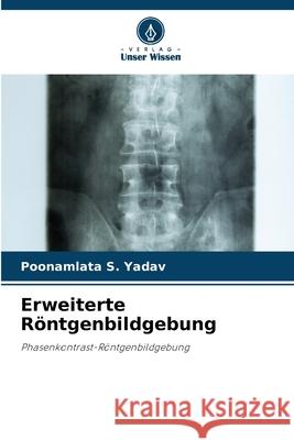 Erweiterte R?ntgenbildgebung Poonamlata S. Yadav 9786207576630 Verlag Unser Wissen - książka