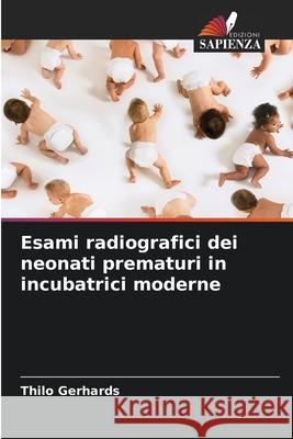 Esami radiografici dei neonati prematuri in incubatrici moderne Gerhards, Thilo 9786203573367 Edizioni Sapienza - książka