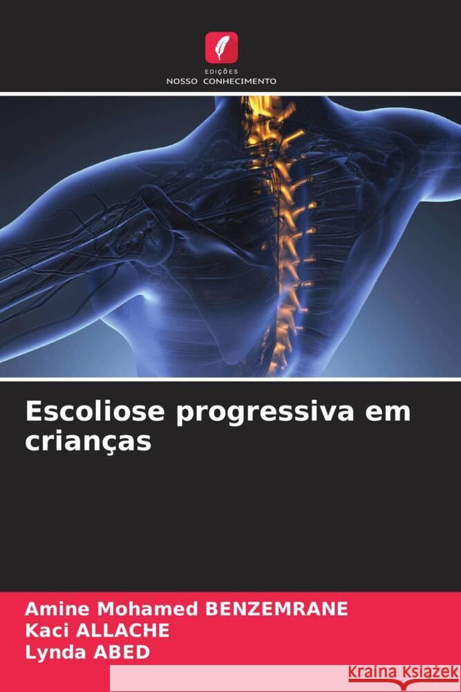 Escoliose progressiva em crianças BENZEMRANE, Amine Mohamed, Allache, Kaci, Abed, Lynda 9786205127452 Edições Nosso Conhecimento - książka