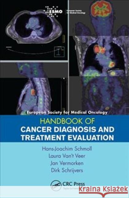 Esmo Handbook of Cancer Diagnosis and Treatment Evaluation Hans-Joachim Schmoll 9781138455375 CRC Press - książka