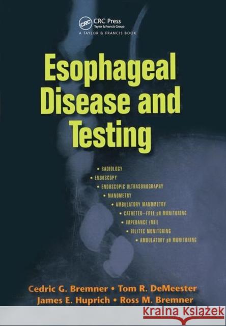 Esophageal Disease and Testing Cedric G. Bremner James E. Huprich Ross M. Bremner 9780824728427 Taylor & Francis Group - książka