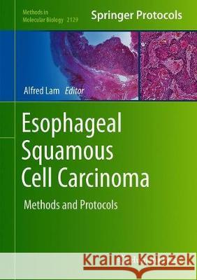 Esophageal Squamous Cell Carcinoma: Methods and Protocols Lam, Alfred K. 9781071603765 Humana - książka