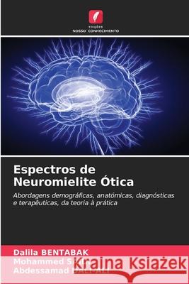 Espectros de Neuromielite Ótica BENTABAK, Dalila, SAÏDI, Mohammed, DALI-ALI, Abdessamad 9786202376389 Edições Nosso Conhecimento - książka