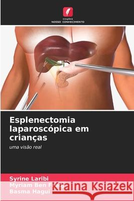 Esplenectomia laparoscópica em crianças Laribi, Syrine, Ben Fredj, Myriam, Hagui, Basma 9786209075162 Edições Nosso Conhecimento - książka