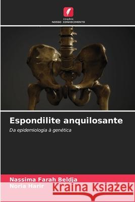 Espondilite anquilosante Beldja, Nassima Farah, Harir, Noria 9786209590658 Edições Nosso Conhecimento - książka