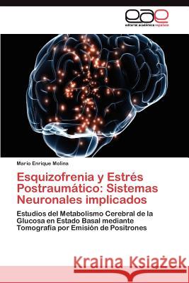 Esquizofrenia y Estrés Postraumático: Sistemas Neuronales implicados Molina Mario Enrique 9783845481807 Editorial Acad Mica Espa Ola - książka