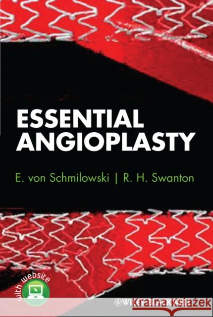 Essential Angioplasty Eva Smilowska Ewa Smilowska Howard Swanton 9780470657263 Wiley-Blackwell - książka