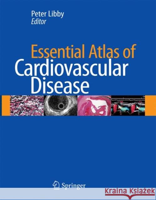 Essential Atlas of Cardiovascular Disease [With CDROM] Libby, Peter 9781573403092 Current Medicine - książka