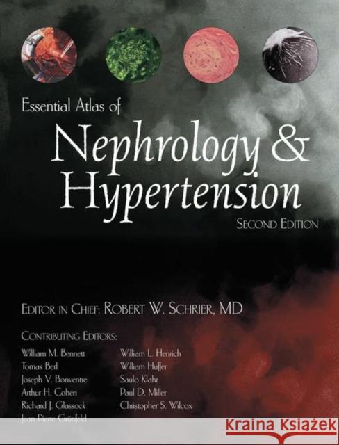 Essential Atlas of Nephrology & Hypertension J. Michael Gaziano Robert Schrier Robert W. Schrier 9781573402231 Current Medicine - książka
