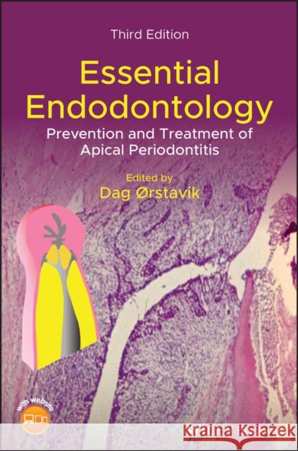 Essential Endodontology: Prevention and Treatment of Apical Periodontitis Orstavik, Dag 9781119271956 John Wiley and Sons Ltd - książka