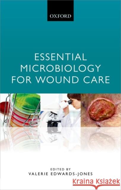 Essential Microbiology for Wound Care Valerie Edwards-Jones 9780198716006 Oxford University Press, USA - książka