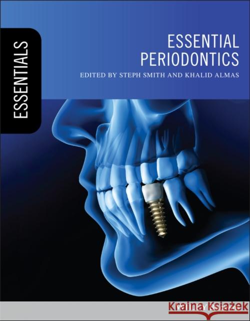 Essential Periodontics Khalid Almas 9781119619628 John Wiley and Sons Ltd - książka