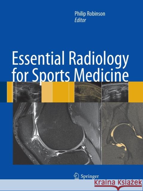 Essential Radiology for Sports Medicine Philip Robinson 9781493951482 Springer - książka