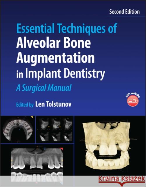 Essential Techniques of Alveolar Bone Augmentation in Implant Dentistry: A Surgical Manual Tolstunov, Len 9781119827320 John Wiley and Sons Ltd - książka