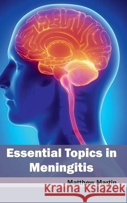 Essential Topics in Meningitis Matthew, Etc Martin 9781632412201 Hayle Medical - książka