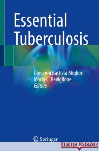 Essential Tuberculosis Giovanni Battista Migliori Mario C. Raviglione 9783030667054 Springer - książka