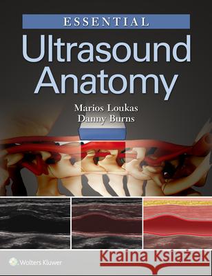 Essential Ultrasound Anatomy Loukas Marios Burns Danny 9781496383532 Lippincott Williams and Wilkins - książka