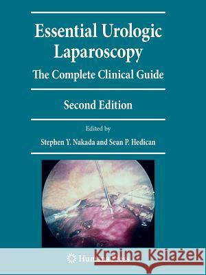 Essential Urologic Laparoscopy: The Complete Clinical Guide Nakada, Stephen Y. 9781493960934 Humana Press - książka