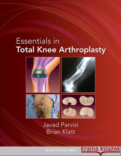 Essentials in Total Knee Arthroplasty Javad Parvizi J. Parvizi 9781556428517 Slack - książka