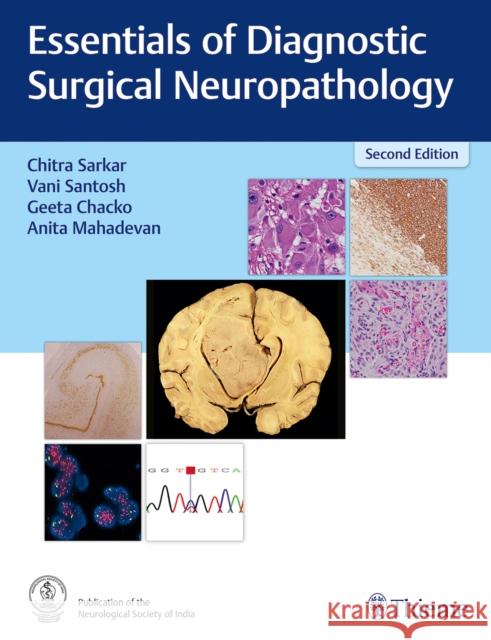 Essentials of Diagnostic Surgical Neuropathology  9789395390057 Thieme Publishers Delhi - książka