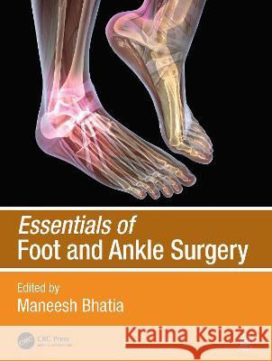 Essentials of Foot and Ankle Surgery Maneesh Bhatia 9780367486495 CRC Press - książka