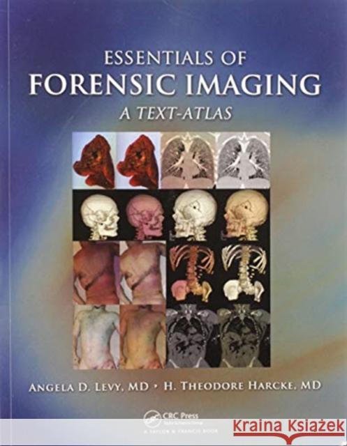 Essentials of Forensic Imaging: A Text-Atlas Angela D. Levy Jr. Harcke 9780367577025 Taylor & Francis Ltd - książka