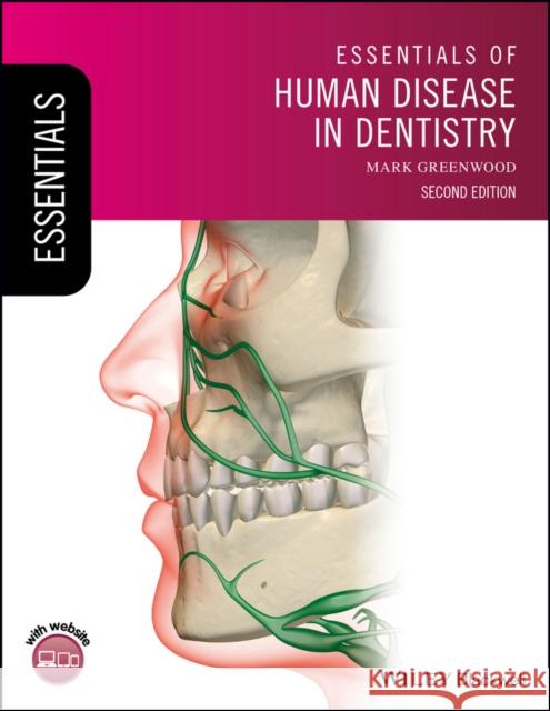 Essentials of Human Disease in Dentistry Mark Greenwood 9781119251842 Wiley-Blackwell - książka