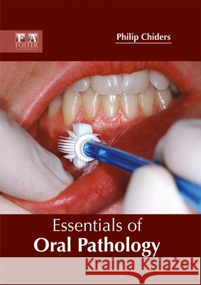 Essentials of Oral Pathology Philip Chiders 9781632424983 Foster Academics - książka