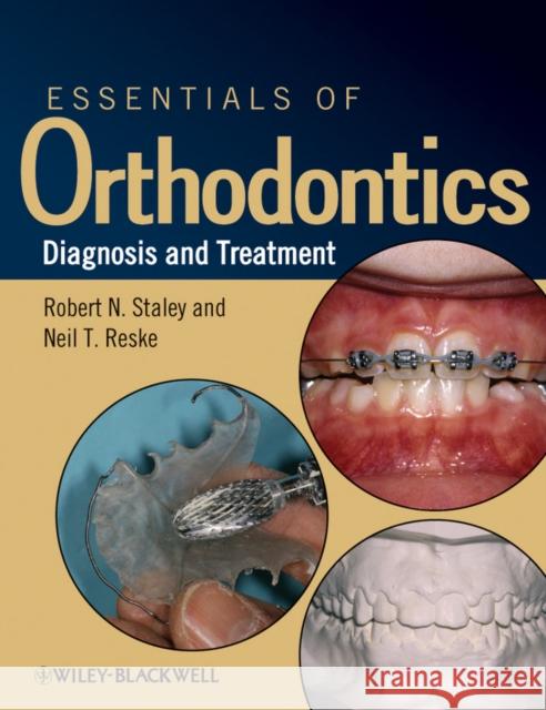 Essentials of Orthodontics: Diagnosis and Treatment Staley, Robert N. 9780813808680 - książka