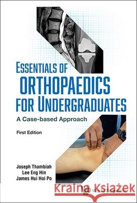 Essentials of Orthopaedics for Undergraduates: A Case-Based Approach Joseph Thambiah Eng Hin Lee James Hui Hoi Po 9789819800087 World Scientific Publishing Company - książka