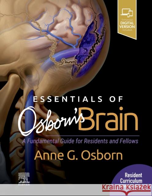 Essentials of Osborn's Brain: A Fundamental Guide for Residents and Fellows Anne G. Osborn 9780323713207 Elsevier - książka