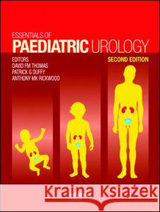 Essentials of Paediatric Urology Thomas Thomas David Thomas Patrick G. Duffy 9781841846330 Informa Healthcare - książka