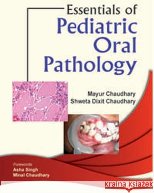 Essentials of Pediatric Oral Pathology Mayur Chaudhary 9789350253748 Jp Medical Ltd - książka