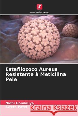 Estafilococo Aureus Resistente à Meticilina Pele Gondaliya, Nidhi, Patel, Sweta 9786209519925 Edições Nosso Conhecimento - książka